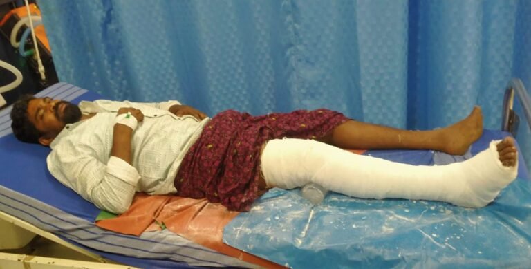 திண்டுக்கல்லில் போலீசாரிடமிருந்து தப்பிச் செல்ல முயன்ற குற்றவாளி கீழே விழுந்து கால் எலும்பு முறிவு